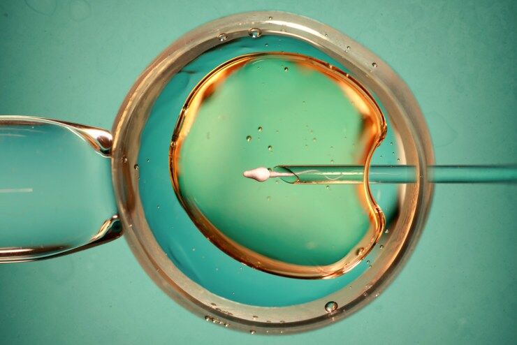 Using acupuncture to enhance IVF